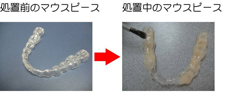 マウスピース