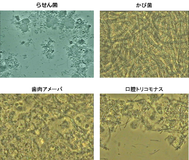菌の種類